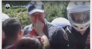 Taulant Balla kritikon protestuesin që pastroi policin me flamurin kuqezi
