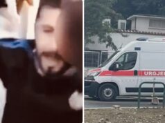 U plagos me plumb gome në sy, 28 vjecari niset drejt Italisë për trajtim të specializuar