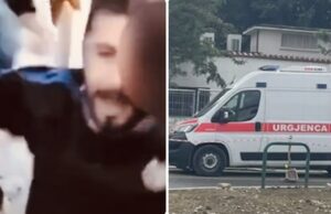 U plagos me plumb gome në sy, 28 vjecari niset drejt Italisë për trajtim të specializuar